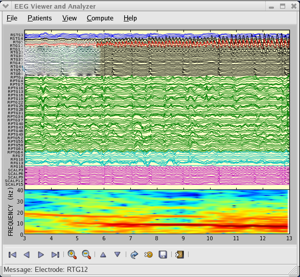 EEG